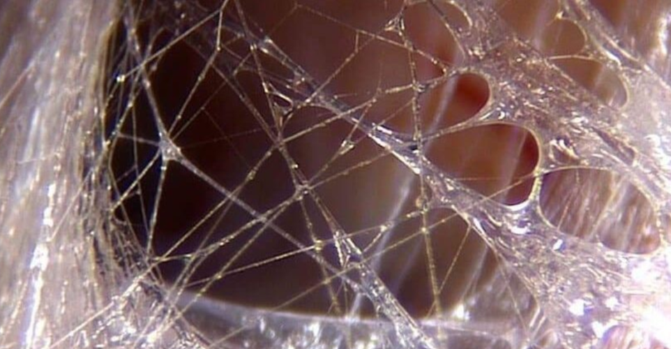 Fascia: het verbindende netwerk dat spanning en herstel beïnvloedt